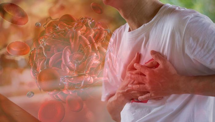 Dünyada en sık görülen ölüm nedeni: Kalp-damar hastalıkları! 5 altın kurala dikkat! Uzmanlar uyarıyor: "Kalıcı hasarlar meydana gelebilir"
