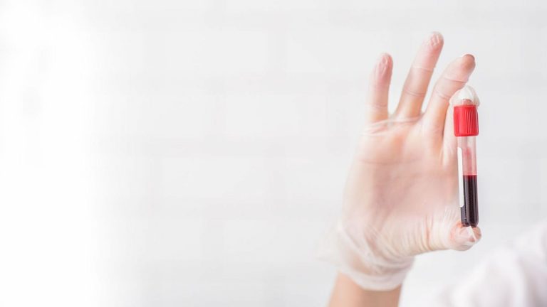 Yapay zeka kan testi Parkinson hastalığının erken teşhisine yardımcı olabilir