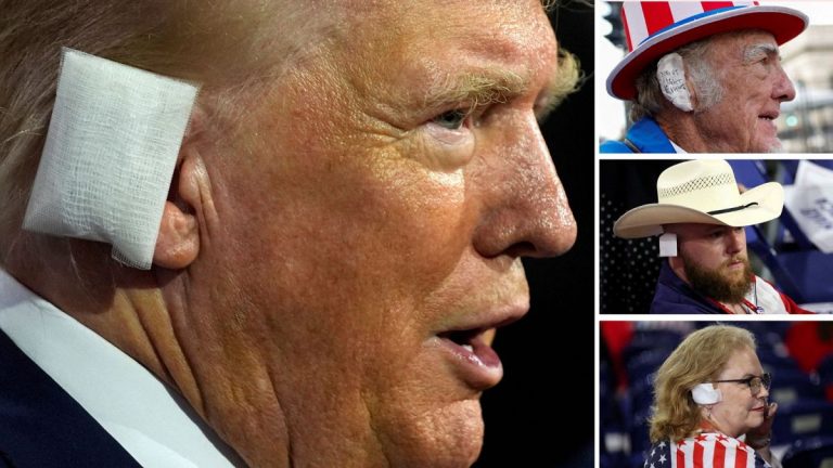Saldırıya uğrayan Trump destekçilerinin yeni trendi: kulak bandajı
